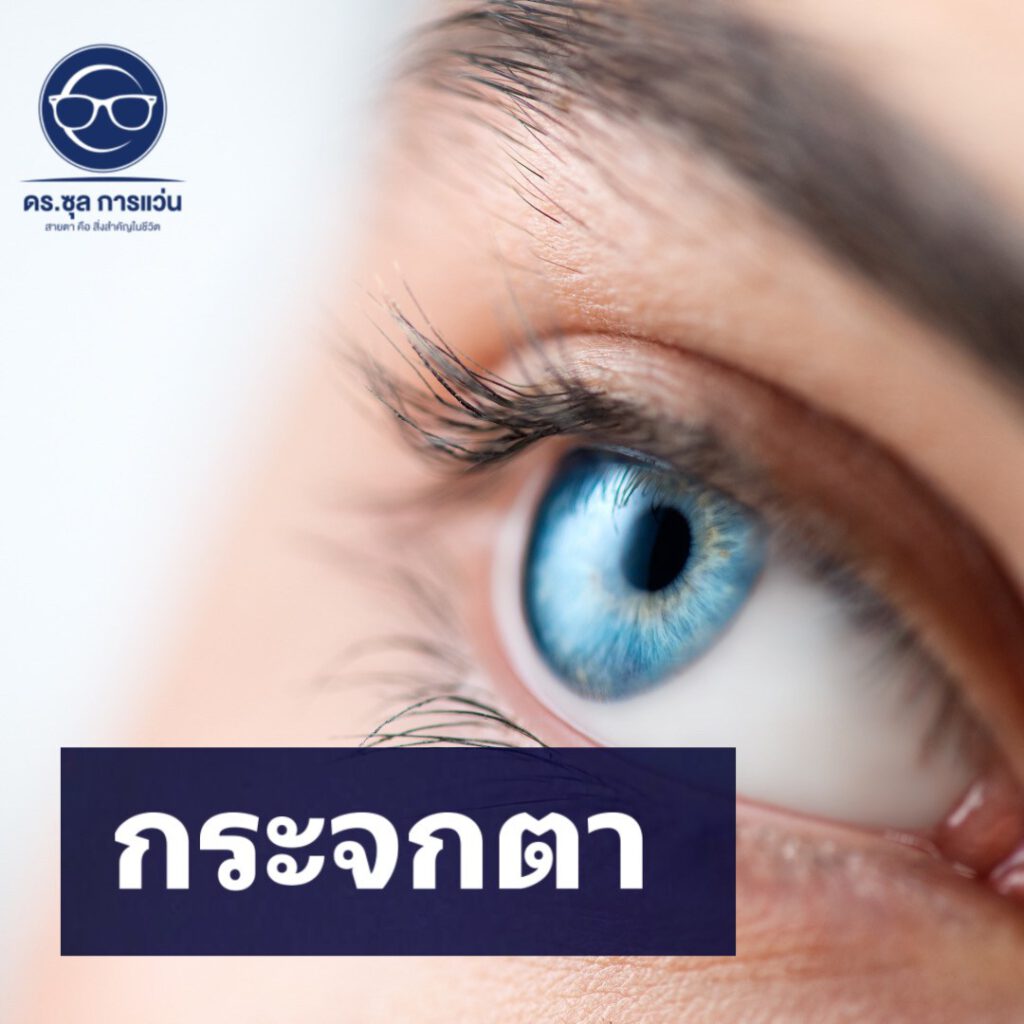 กระจกตา (cornea)